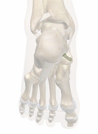 Plantar Calcaneonavicular Ligament