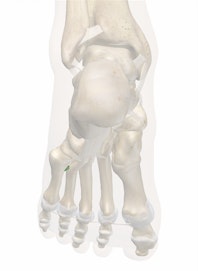 Plantar Metatarsal Ligaments