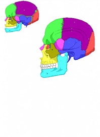 Posterior Fontanelle