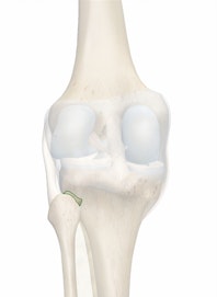 Posterior Ligament