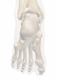 Posterior Talofibular Ligament