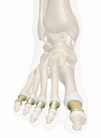 Proximal Phalanges of the Foot