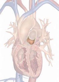 Pulmonary Valve
