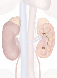 Renal Papilla