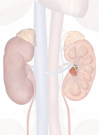 Renal Pelvis