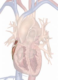 The Right Atrium