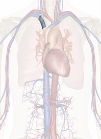Right Brachiocephalic Vein