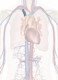 Right Brachiocephalic Vein