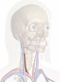 Right Common Carotid Artery