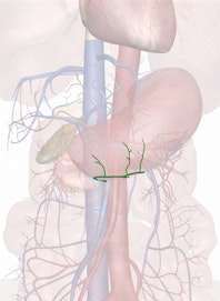 Right Gastroepiploic Vein
