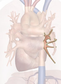 Right Inferior Pulmonary Vein