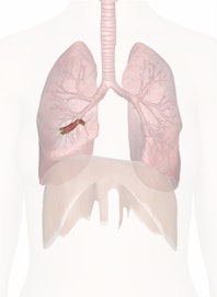 Right Lower Lobe Bronchus (Secondary)