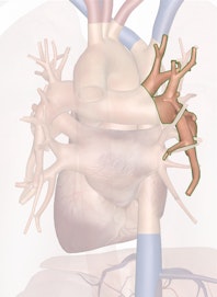 Right Pulmonary Artery