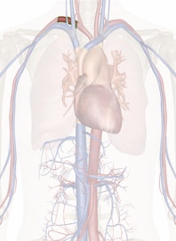 Right Subclavian Artery