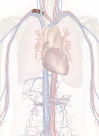Right Subclavian Artery