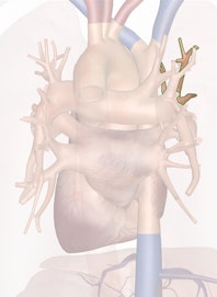 Right Superior Pulmonary Vein