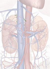 Right Suprarenal Arteries