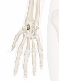 The Scaphoid Bone