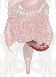 The Sigmoid Colon