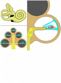 Spiral Ganglion