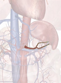 Splenic Artery