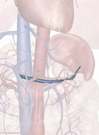 Splenic Vein