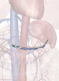 Splenic Vein