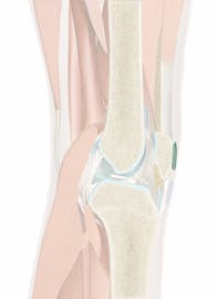 Subcutaneous Prepatellar Bursa