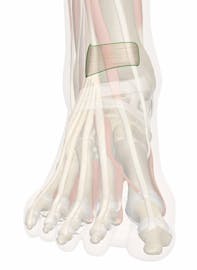 Superior Extensor Retinaculum