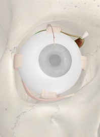 Superior Oblique Muscle