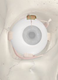 Superior Rectus Muscle