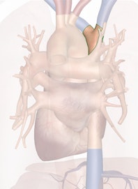 Superior Vena Cava