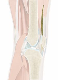 Suprapatellar Fat Body