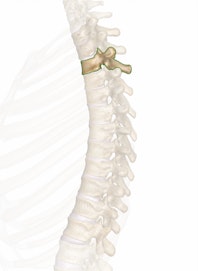 T3 (3rd Thoracic Vertebra)