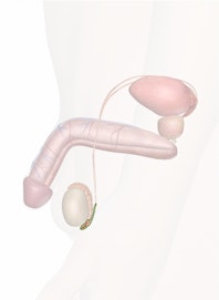 Tail of Epididymis