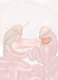 Tail of Pancreas
