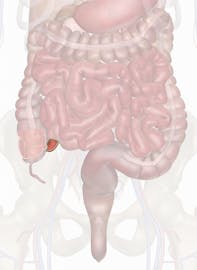 The Terminal Ileum