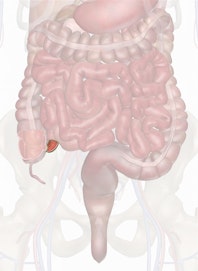 The Terminal Ileum