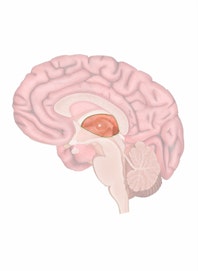 Thalamus (3rd Ventricle)