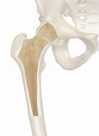Trabecular (Spongy) Bone