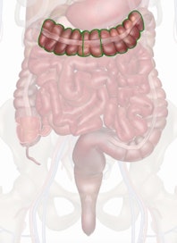 Transverse Colon