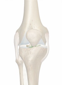 Transverse Ligament of Knee