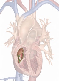Tricuspid Valve