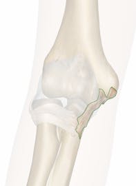 Ulnar Collateral Ligament of Elbow