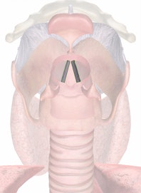 Vocal Ligaments