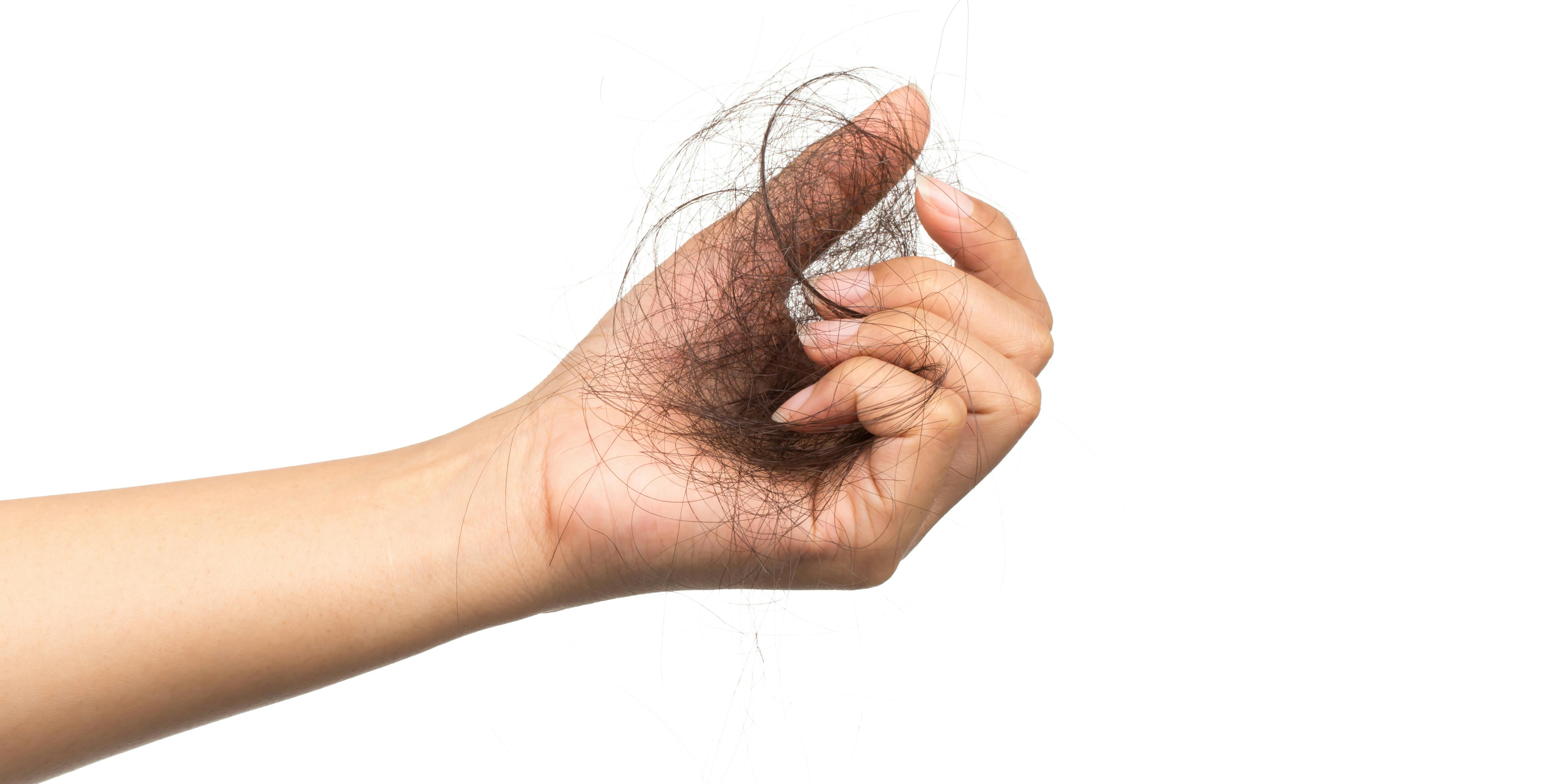 Could your diet be causing hair loss?