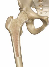 Femur Cross-Section