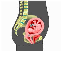 Fetus (Second Trimester)
