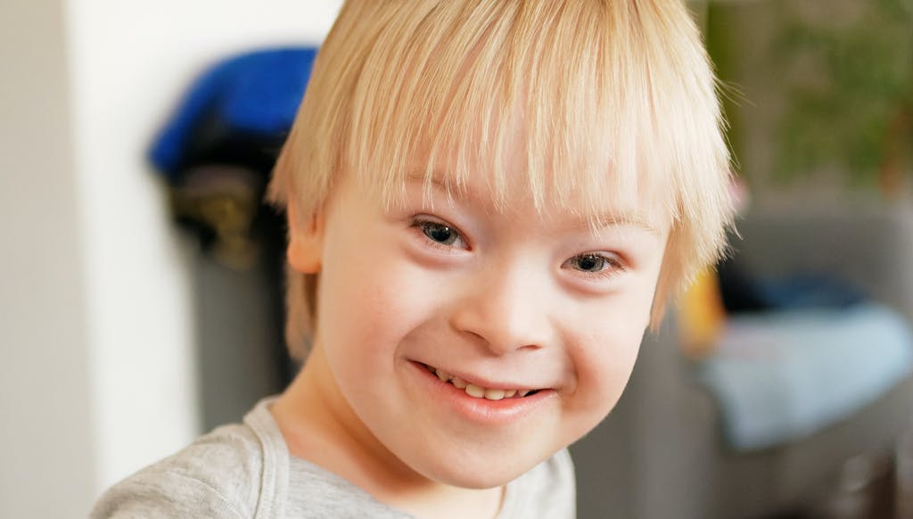 How Down Syndrome Affects Sleep