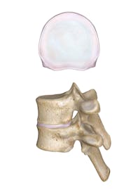 The Intervertebral Discs
